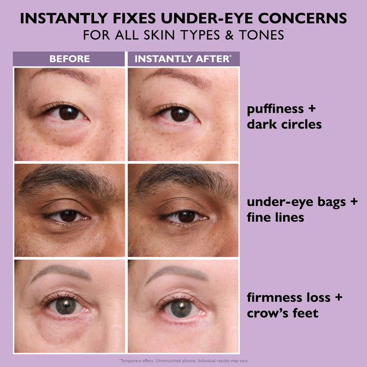 Instant FirmX Eye Tightener