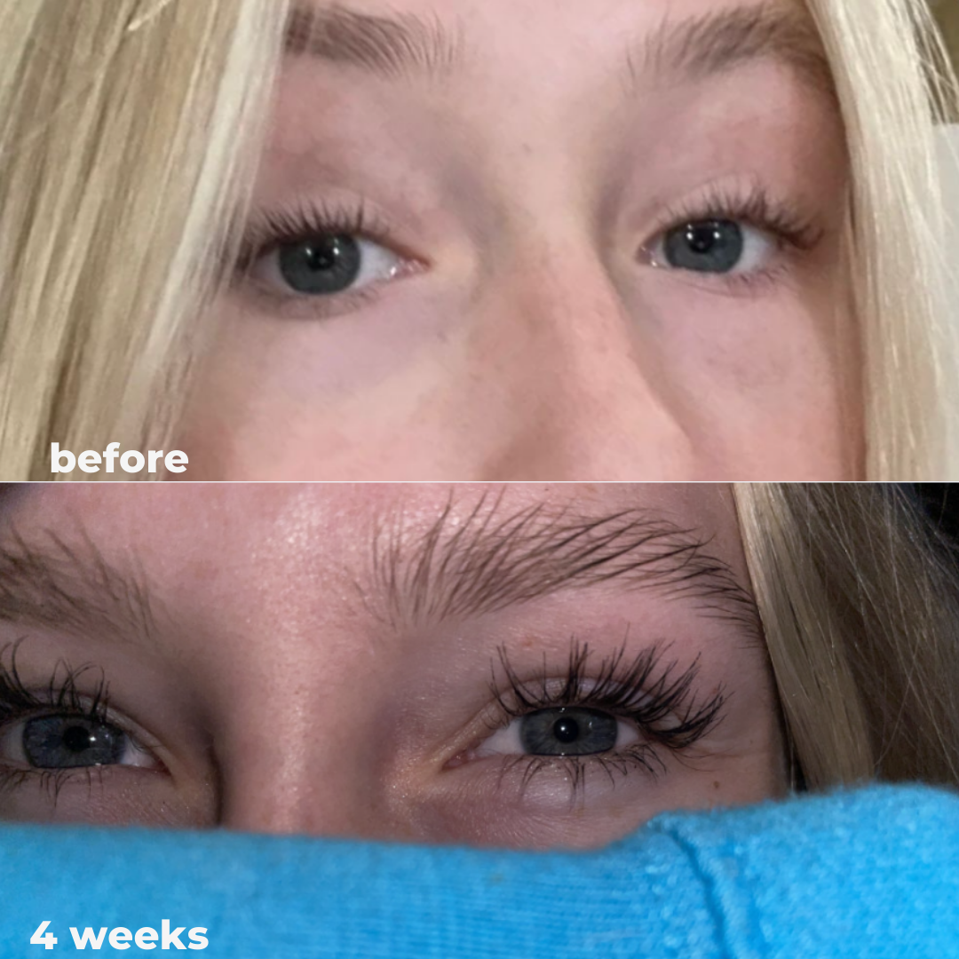 Eyelash Growth Serum